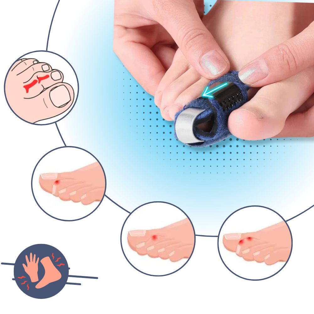 Adjustable & Discreet Fit Toe Straightener - Ozerty