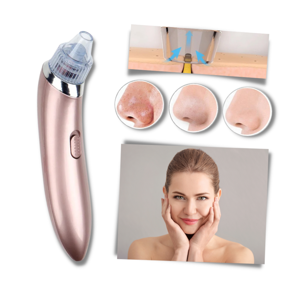 Facial Blackhead Remover Set - Ozerty