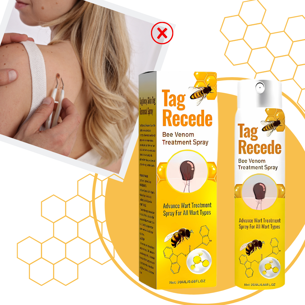 Non-Invasive Tag Recede - Ozerty