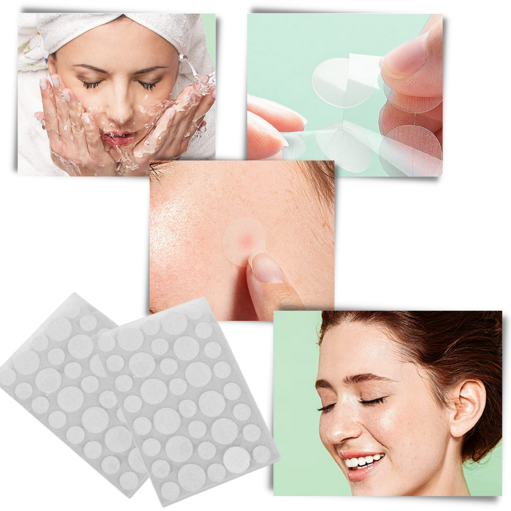 36-Pack Invisible Acne Patches