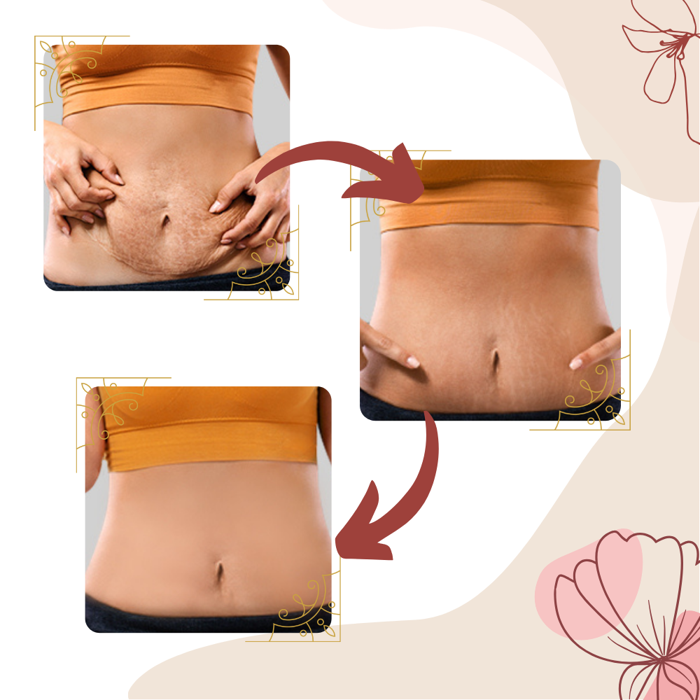 High Frequency Vibration Cellulite Massager - Ozerty